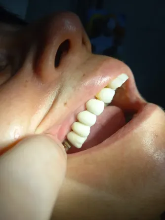 CONSULTORIO ODONTOLOGICO , ODONTOLOGIA GRAL E IMPLANTES La Paternal