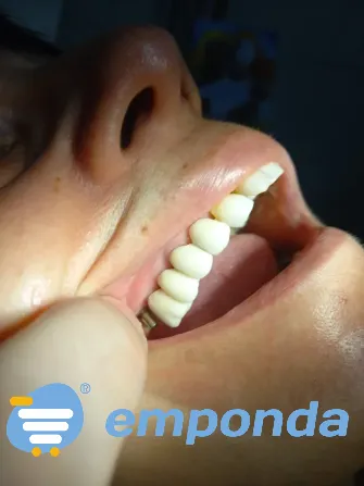 CONSULTORIO ODONTOLOGICO , ODONTOLOGIA GRAL E IMPLANTES La Paternal - imagen 1