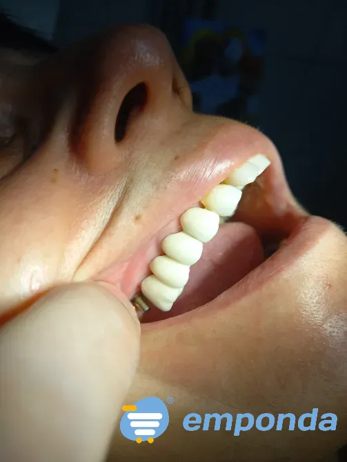 CONSULTORIO ODONTOLOGICO , ODONTOLOGIA GRAL E IMPLANTES La Paternal - imagen 1