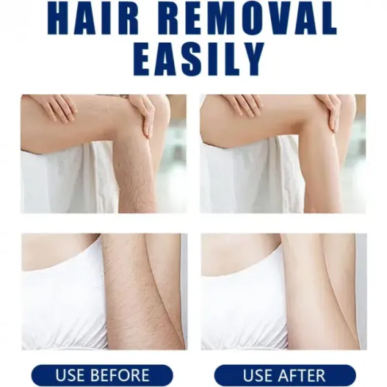 Depilador Exfoliante Sin Dolor De Cristal Floresta