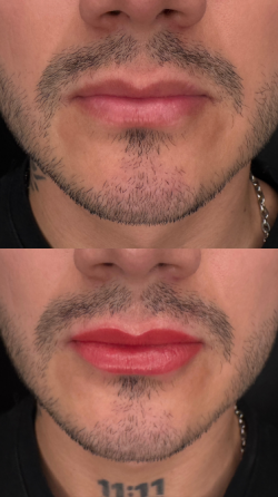 Micropigmentación masculina y femenina – Stanislav Recoleta