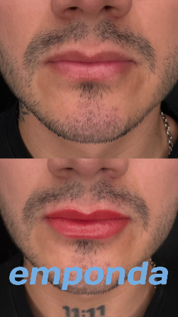 Micropigmentación masculina y femenina – Stanislav Recoleta - imagen 2